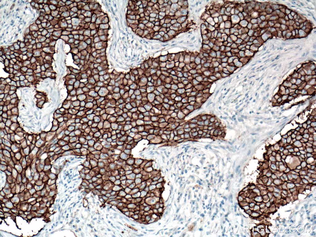 Immunohistochemistry